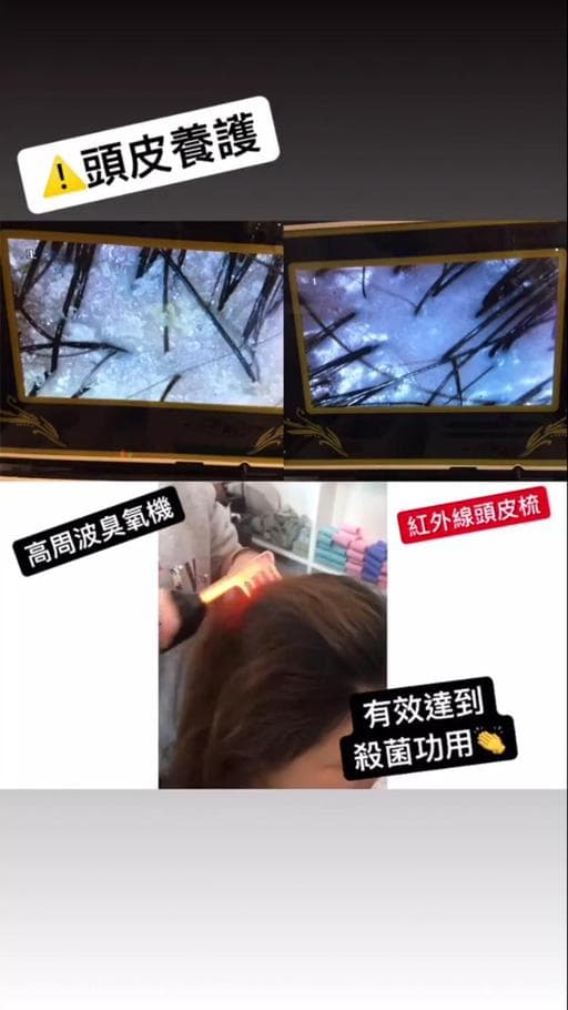 頭皮護理