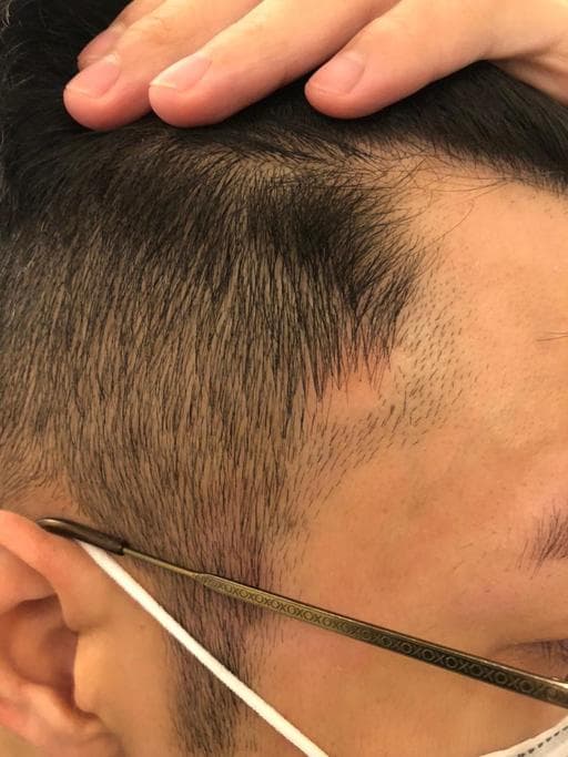 粗硬髮、乾性、短瀏海