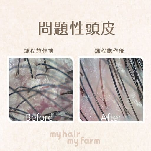 頭皮護理、頭皮問題、頭氣味
