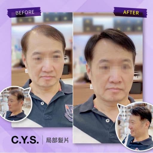 男生短髮、短瀏海、油性頭皮