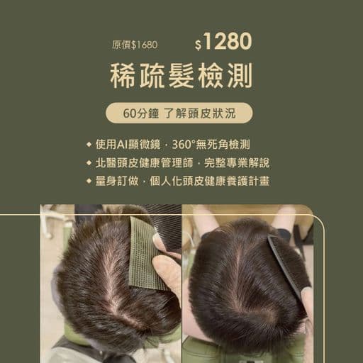 外泌體育髮、掉髮抽血檢查、頭髮稀疏